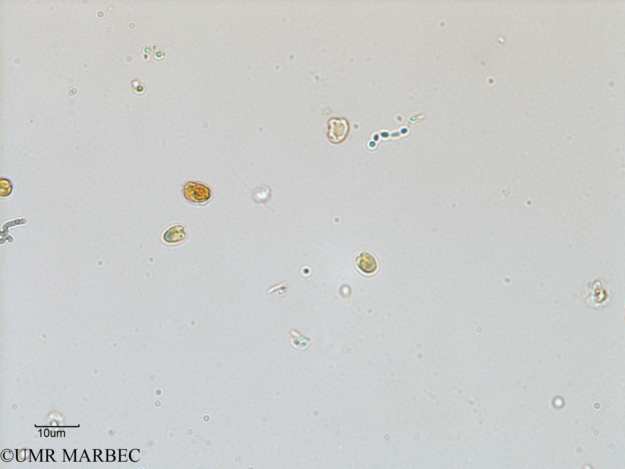 phyto/Scattered_Islands/juan_de_nova/COMMA2 November 2013/Nanoflagellé 9 (ancien Flagellé 2-3).tif(copy).jpg